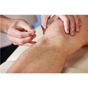 דיקור ותרפיה מנואלית - תמונה דיקור ותרפיה מנואלית - תמונה